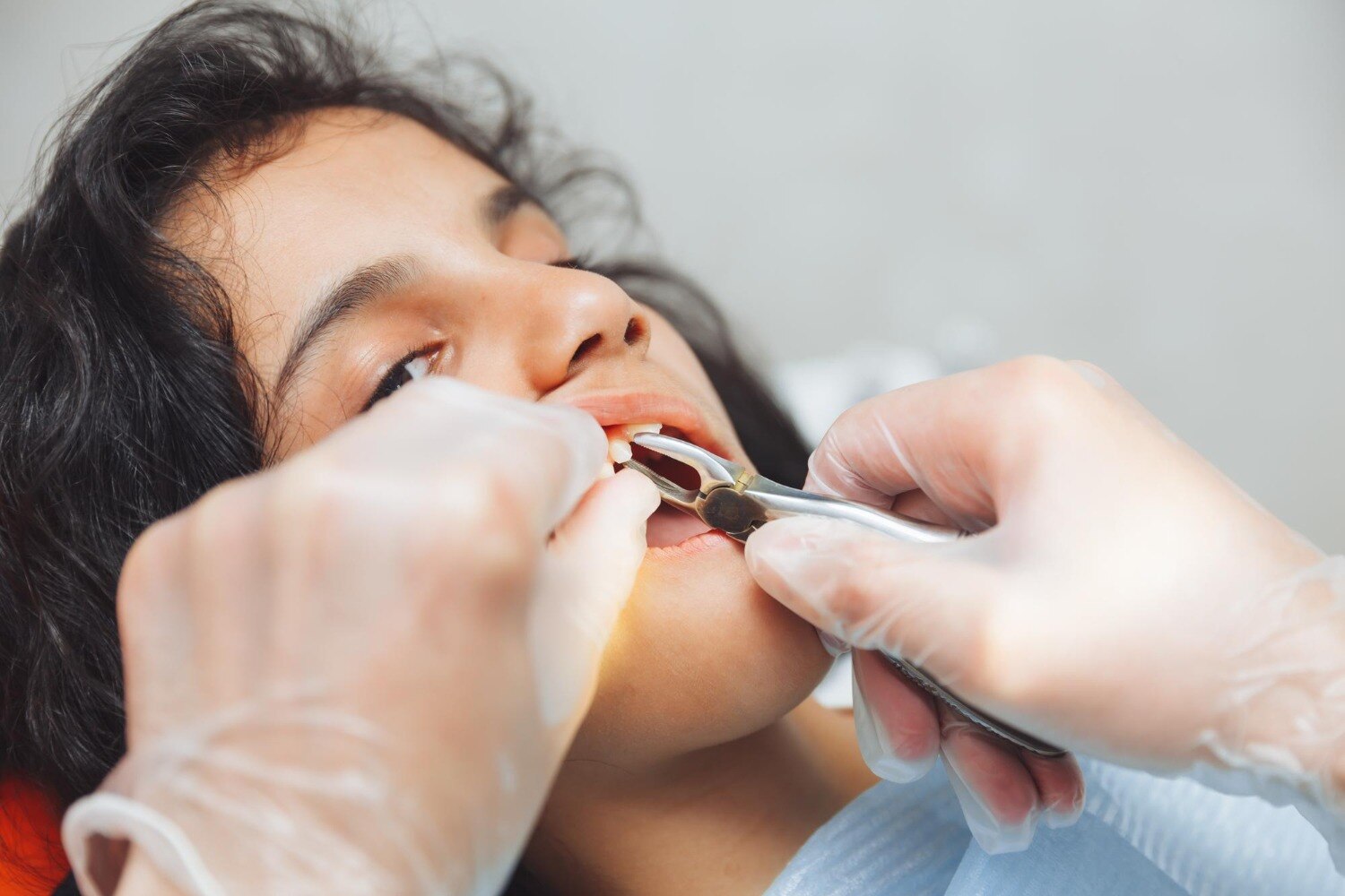 When Is Tooth Extraction Necessary and What Should You Expect