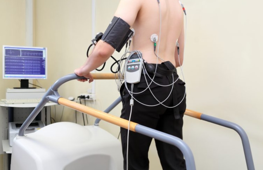 TMT Test When Is It Recommended and What Happens During the Test