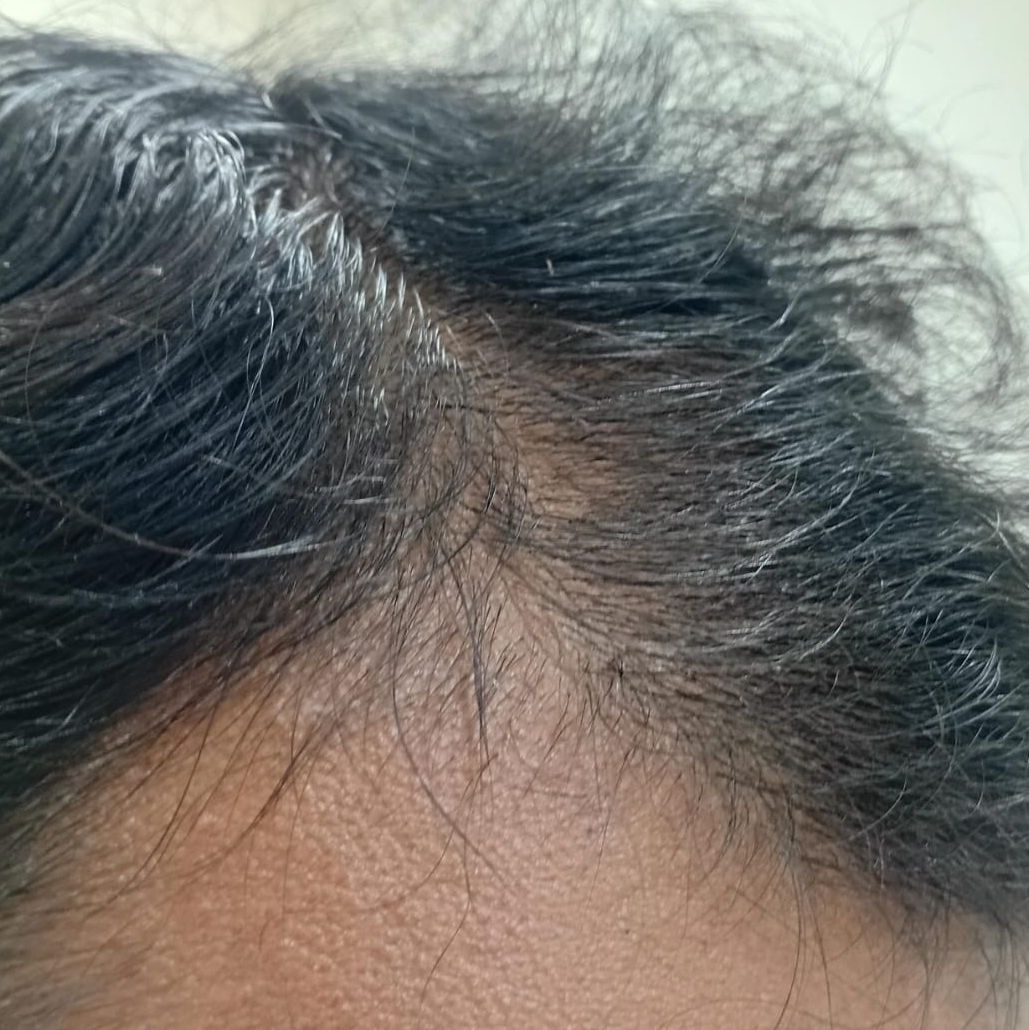 Vibha skin