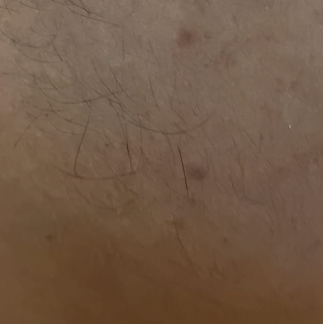 Vibha skin