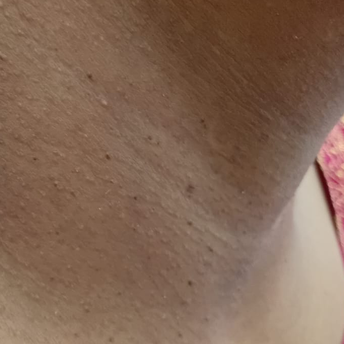 Vibha skin