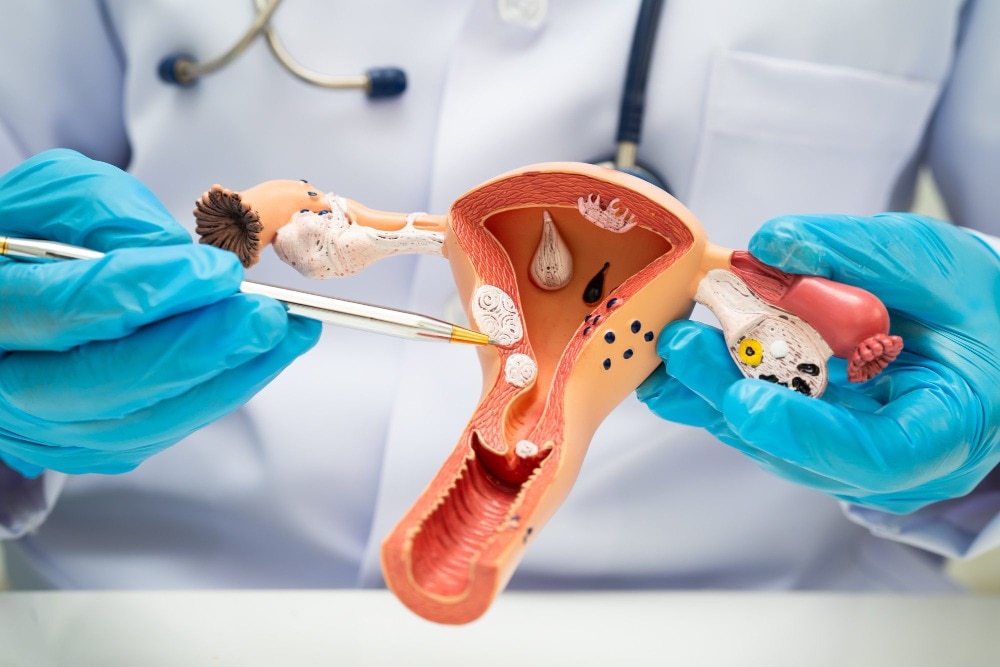 Vaginal Tightening Procedures and Important Gynaecological Considerations