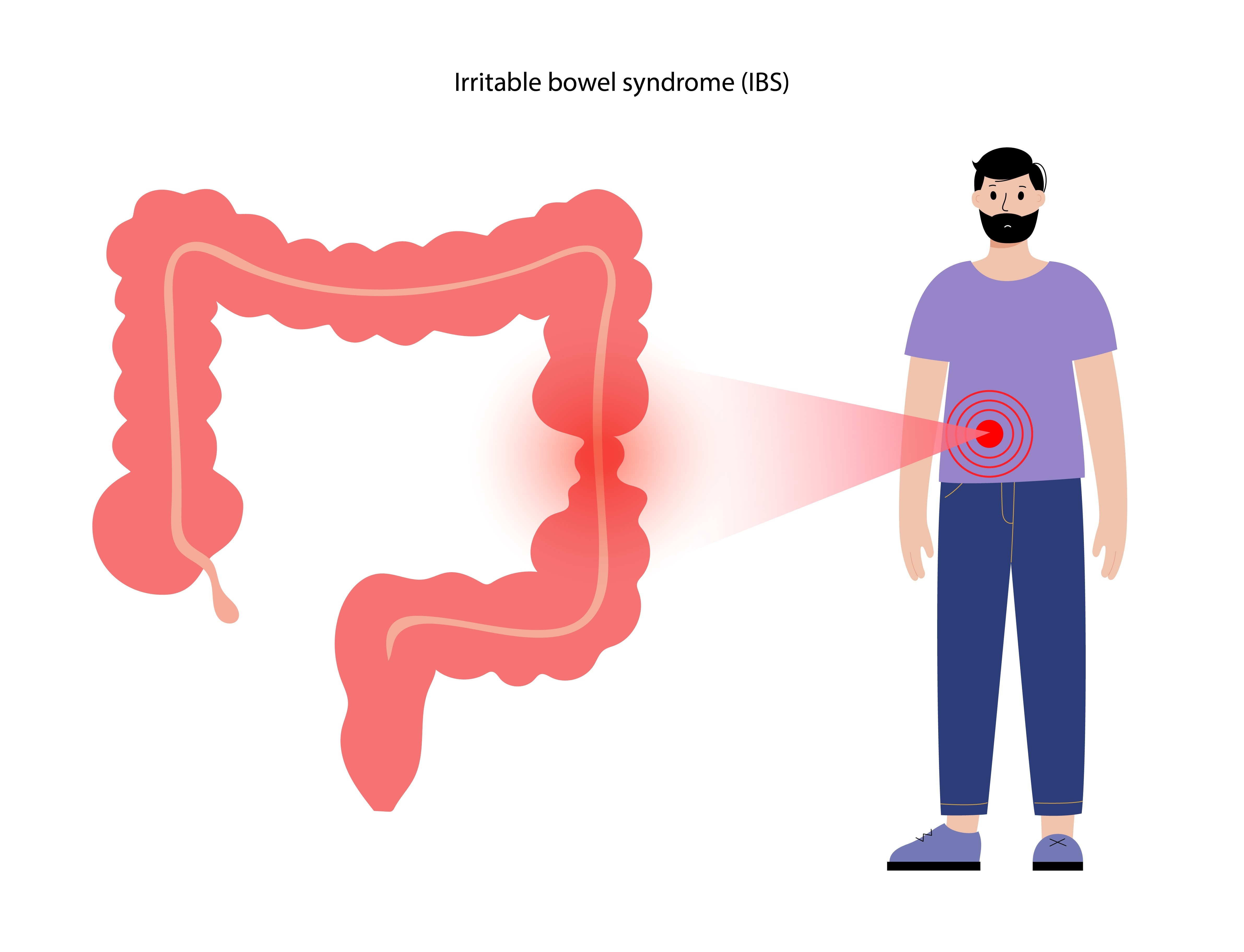 Understanding Irritable Bowel Syndrome and Common Triggers Behind Recurring Symptoms
