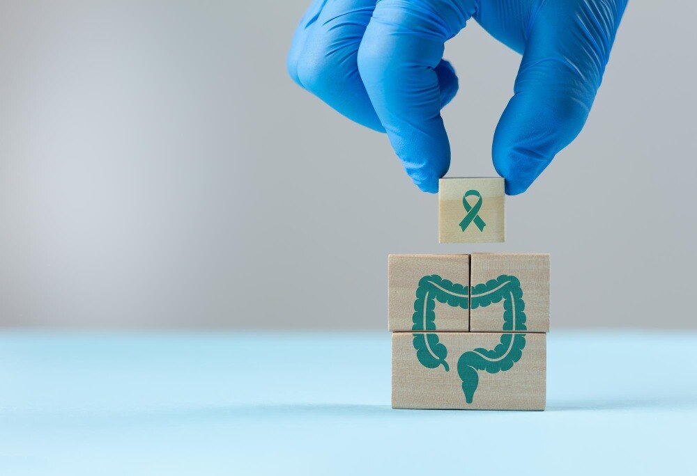 Cancer Specialist for Colon Cancer in Dombivli East