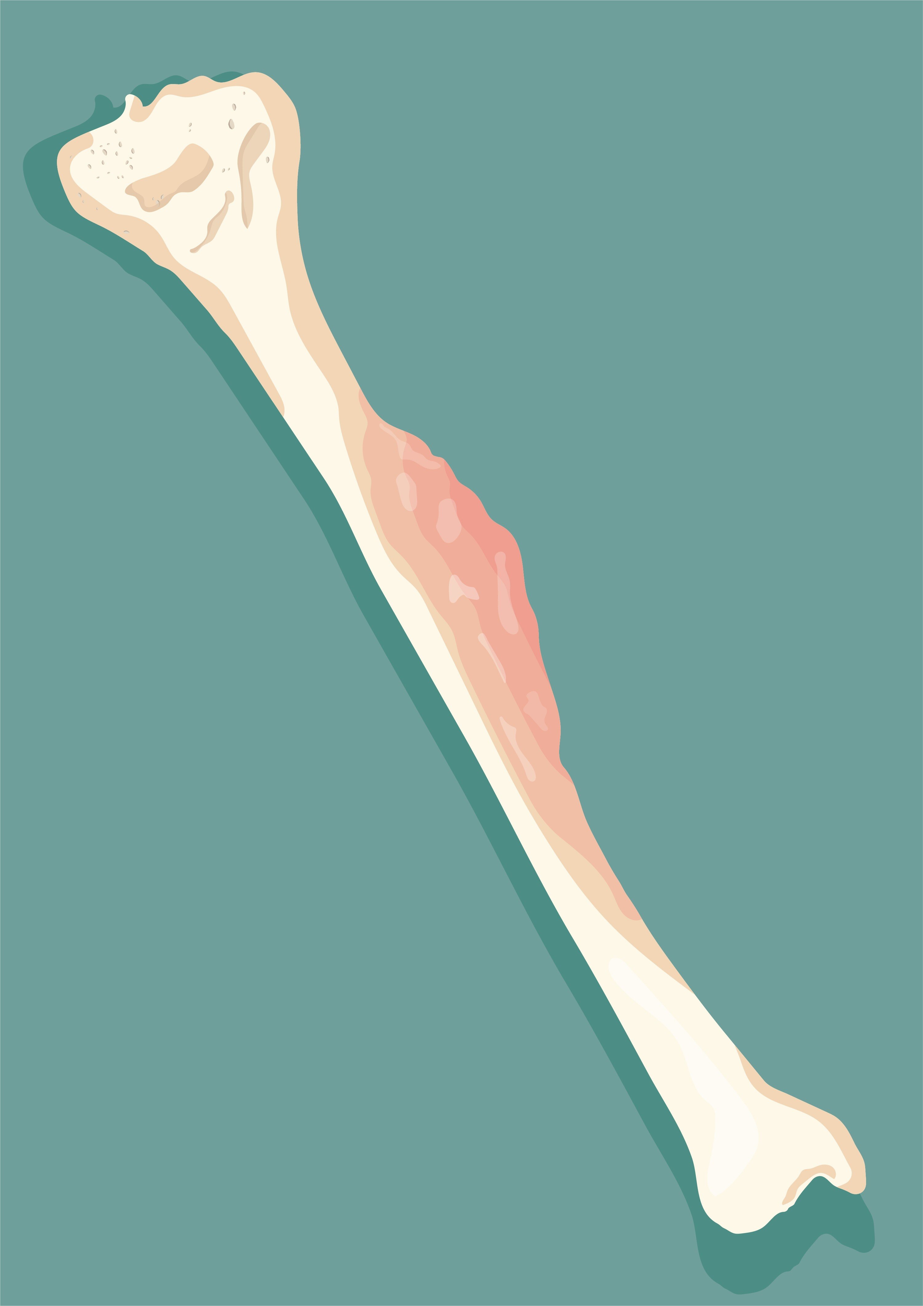 Bone Cancer Symptoms That Should Lead to Further Medical Evaluation
