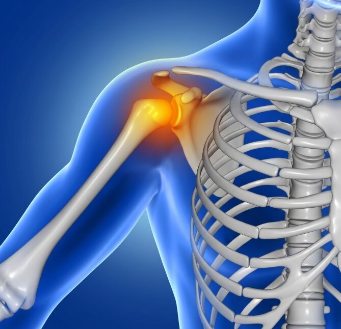 Chondrosarcoma How This Cartilage Cancer Is Diagnosed and Treated