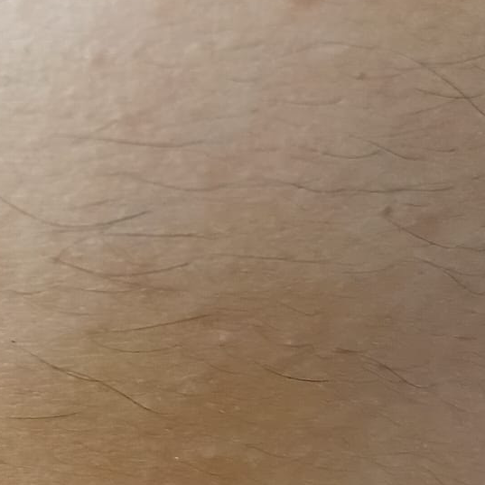 Vibha skin