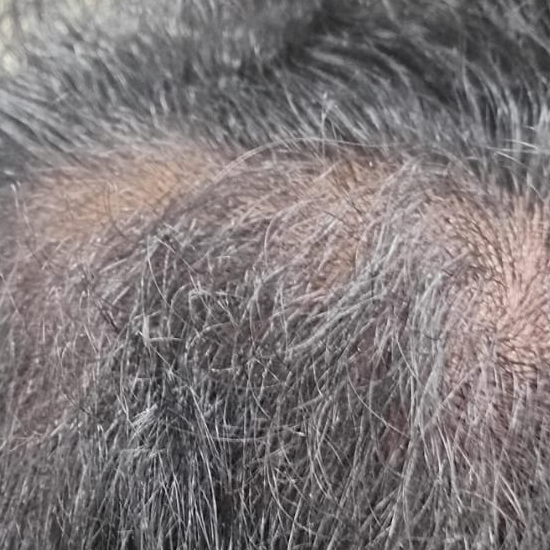 Vibha skin