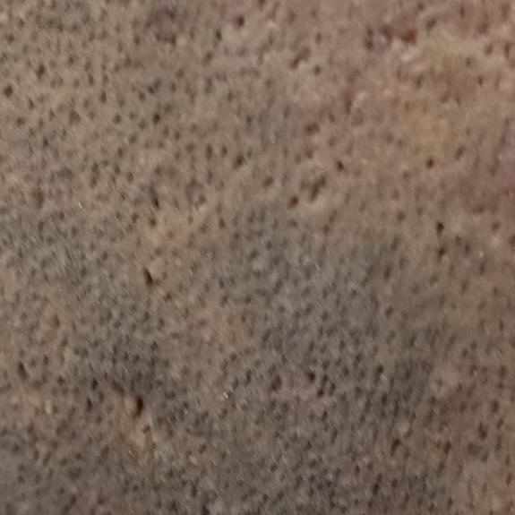 Vibha skin