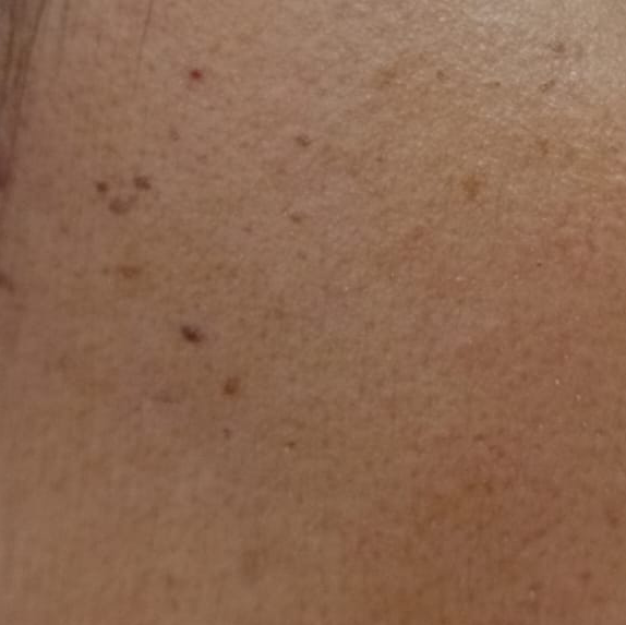 Vibha skin