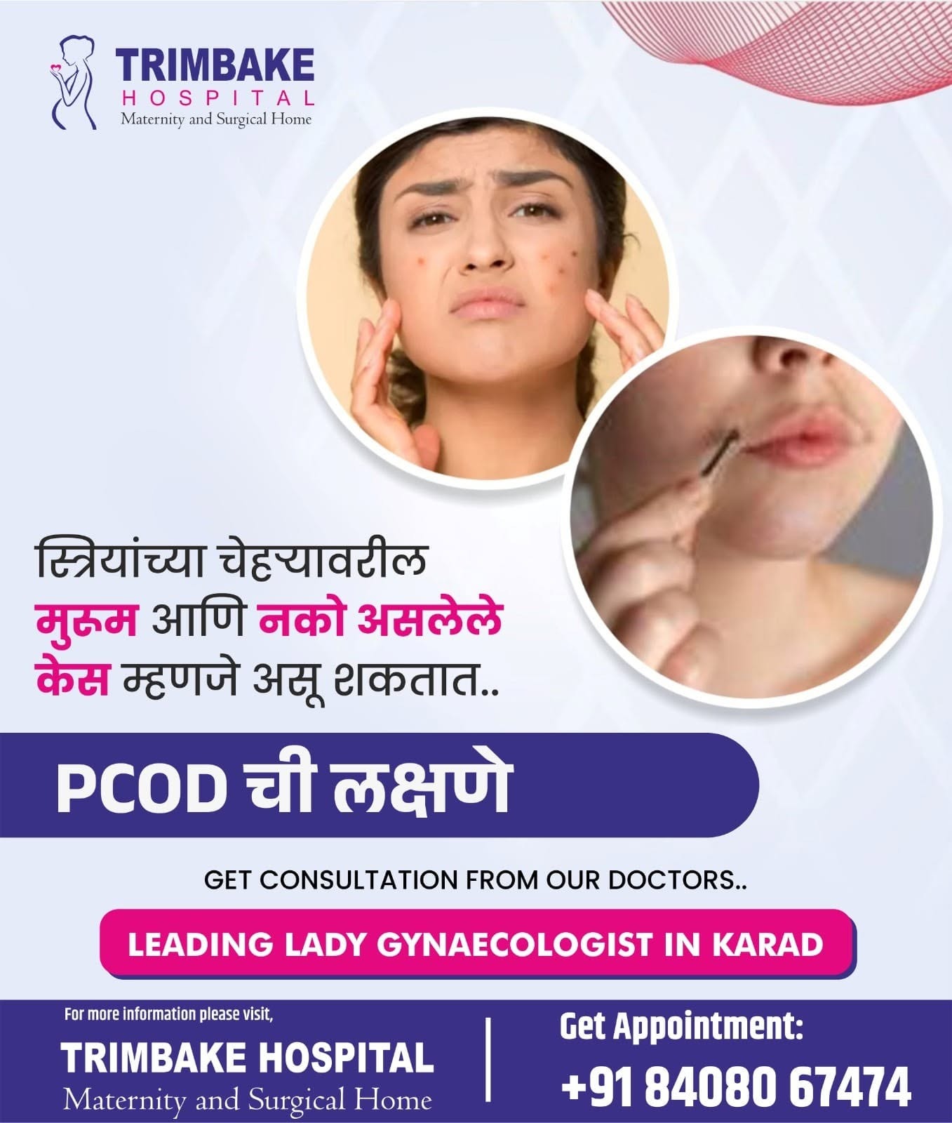 पीसीओडी (PCOD) म्हणजेच पॉलीसिस्टिक ओव्हेरियन डिसीज हि महिलांमध्ये उद्भवणारी मासिक पाळीशी संबधित स्ति...