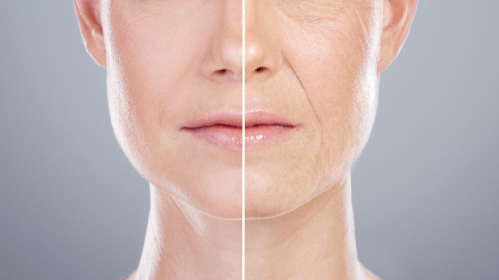 Anti-Aging Treatment in Mumbai: How to Choose a Plan That Still Looks Natural