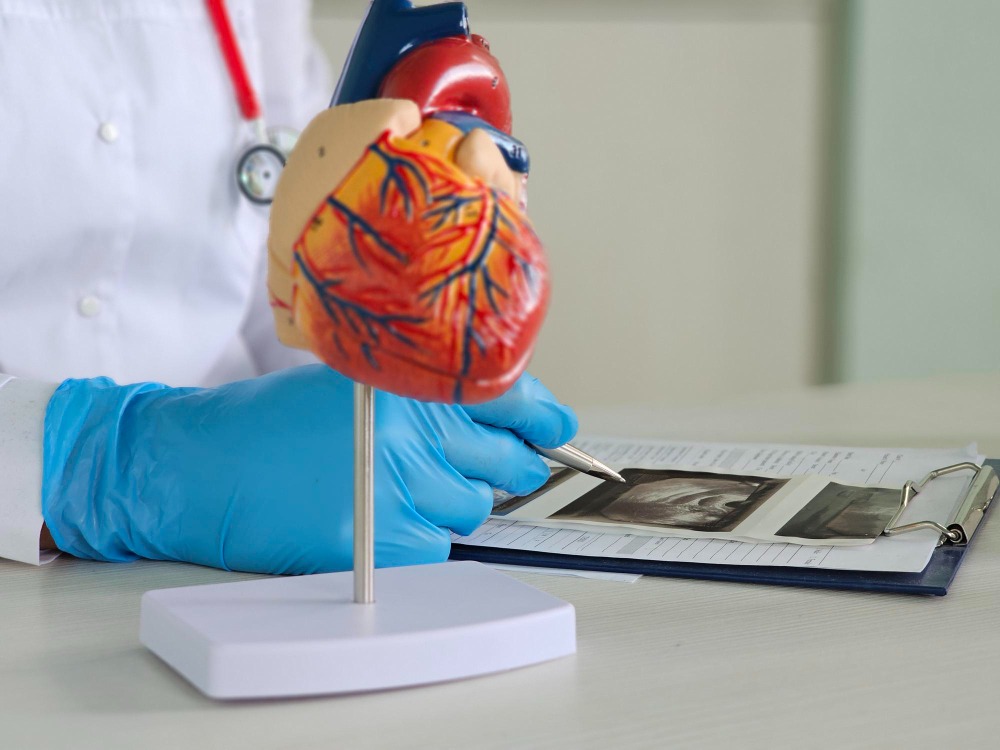 Choosing a Cardiology Doctor for Coronary Angiography and Angioplasty
