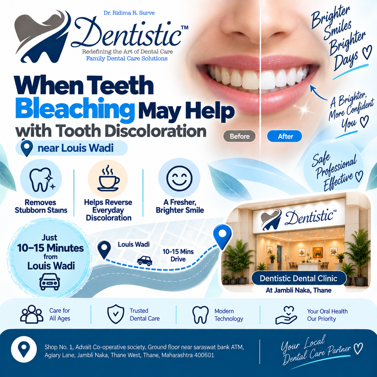 When Teeth Bleaching May Help with Tooth Discoloration in Louis Wadi