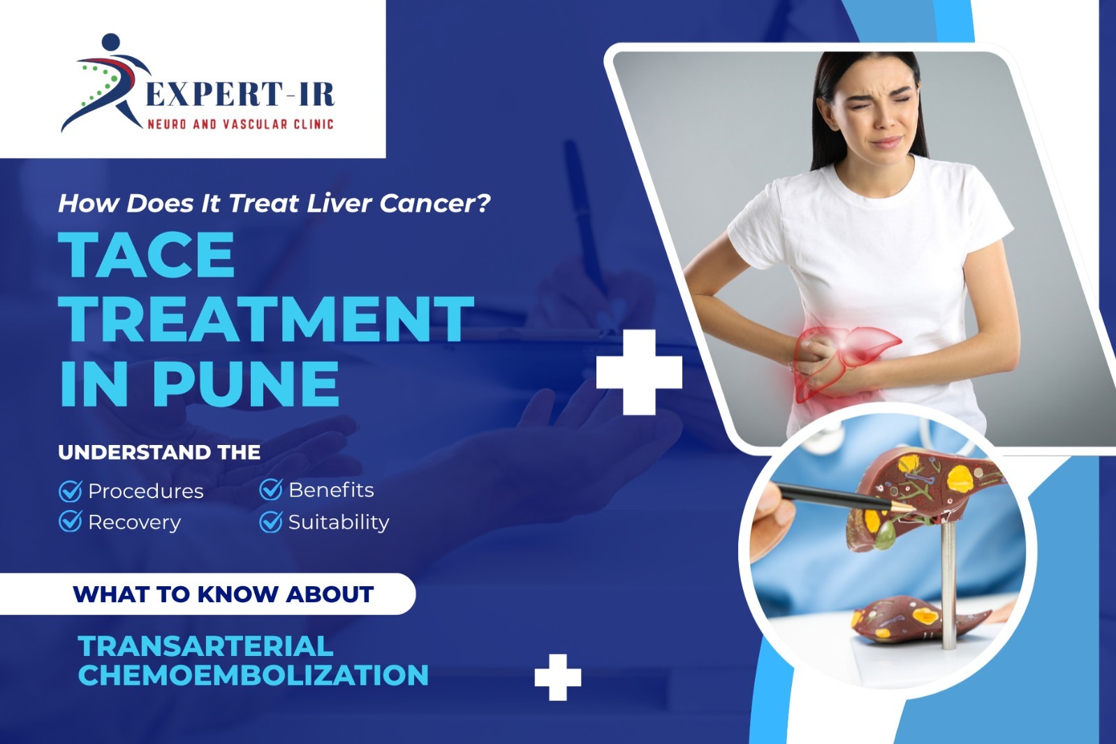TACE Treatment in Pune: How Does It Treat Liver Canc