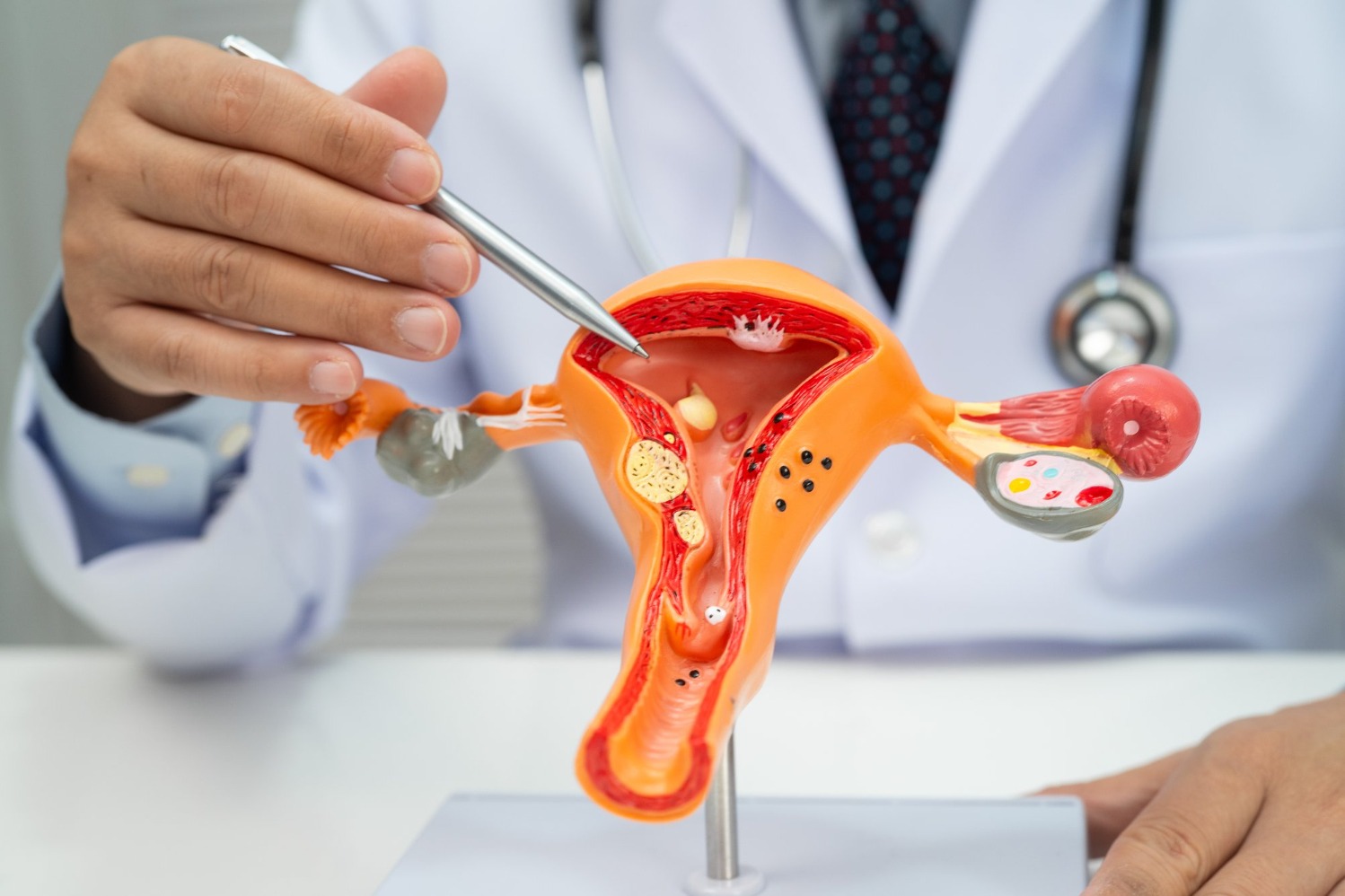 When a PCOD Specialist Can Help With Irregular Cycles and Fertility Concerns