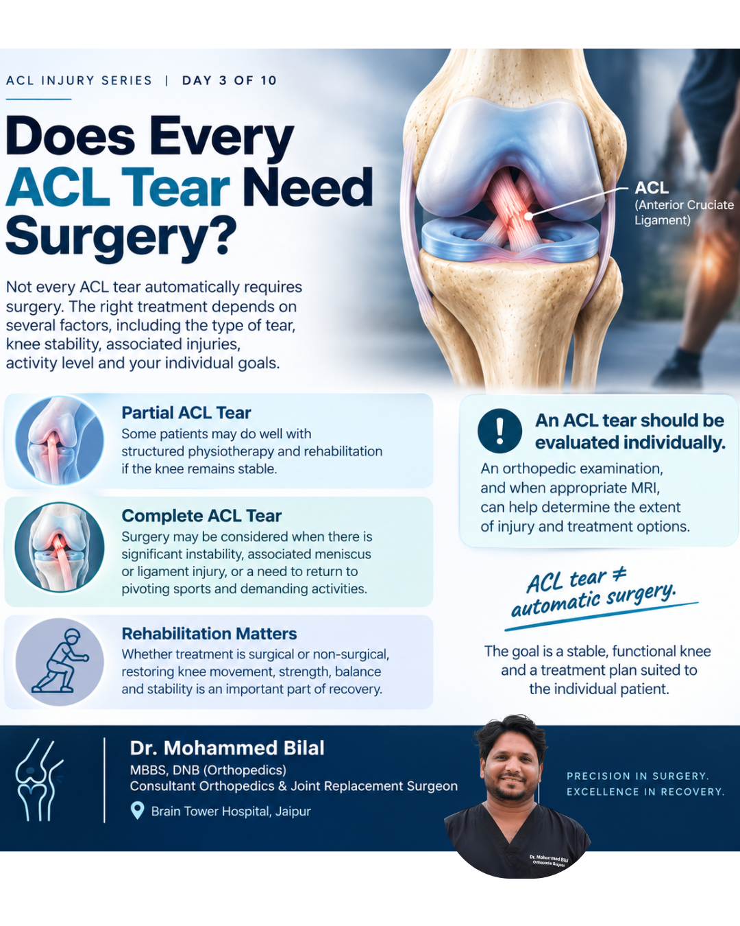 Does Every ACL Tear Need Surgery? Orthopedic, Surgery, Pain, Trauma, ACL, Fracture, Tear, Jaipur