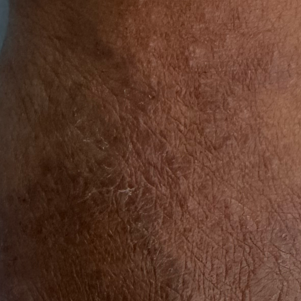 Vibha skin