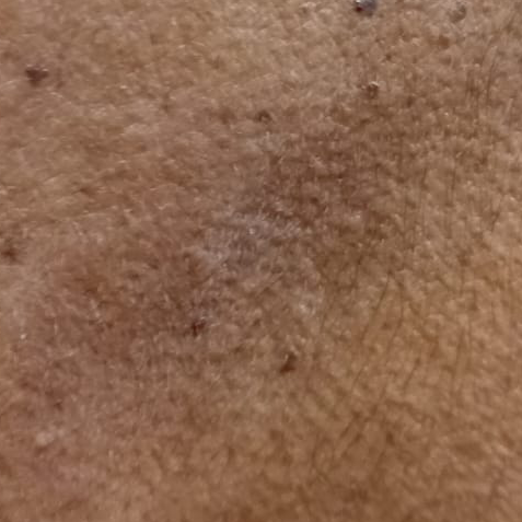Vibha skin