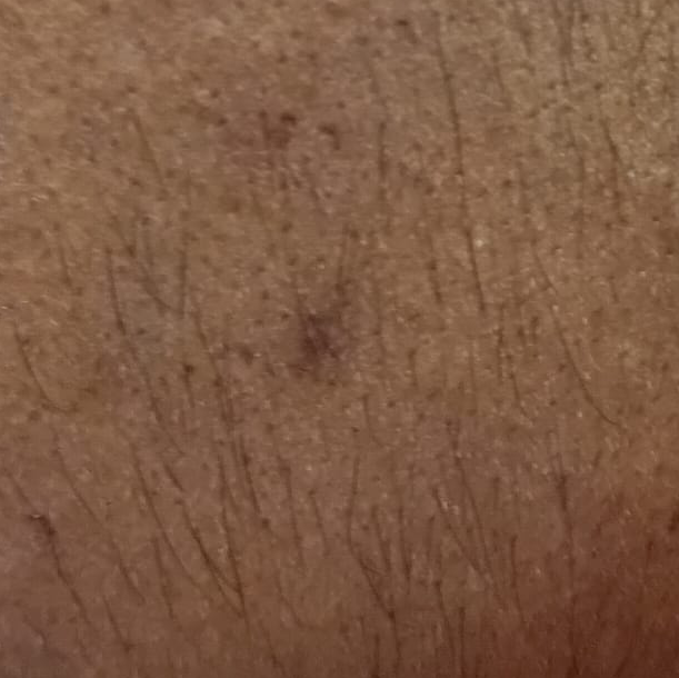 Vibha skin