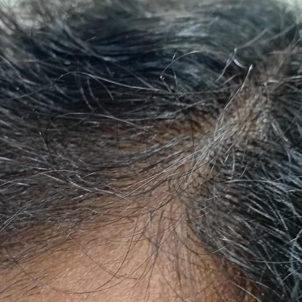 Vibha skin