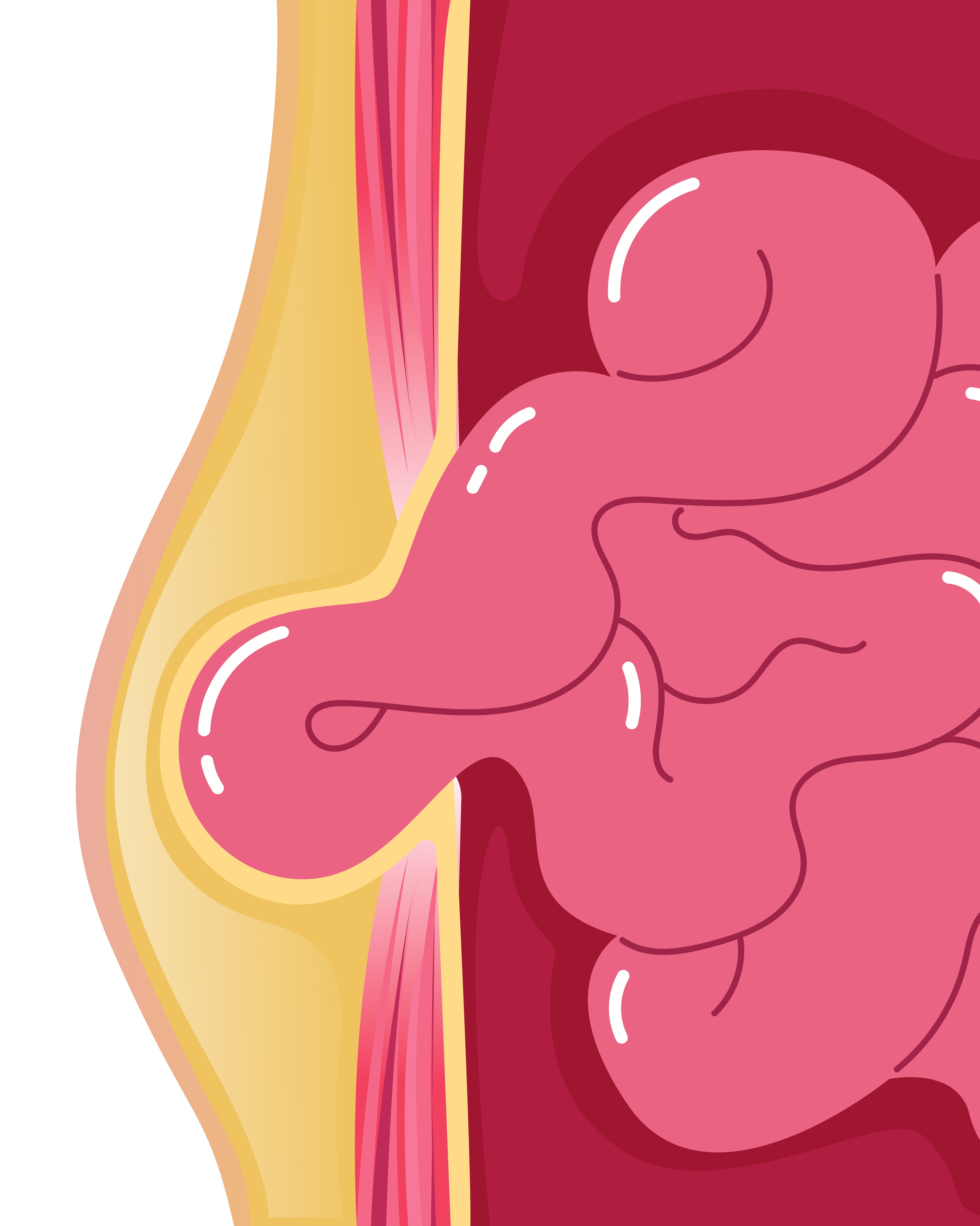 Hernia Surgeon in Pune Signs You May Need Surgical Evaluation