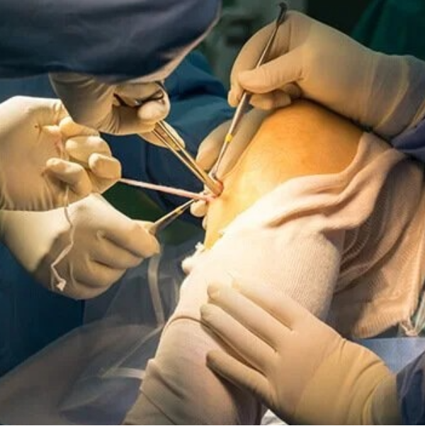 Best Orthopedic Surgeon in Pune A Practical Checklist Before Choosing Your Doctor