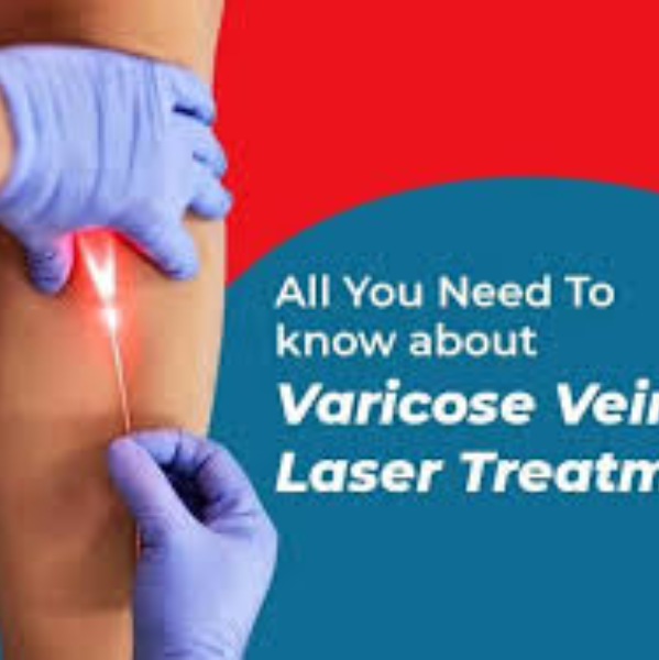 Varicose Vein Treatment in Goregaon Signs That It Is Time for an Evaluation