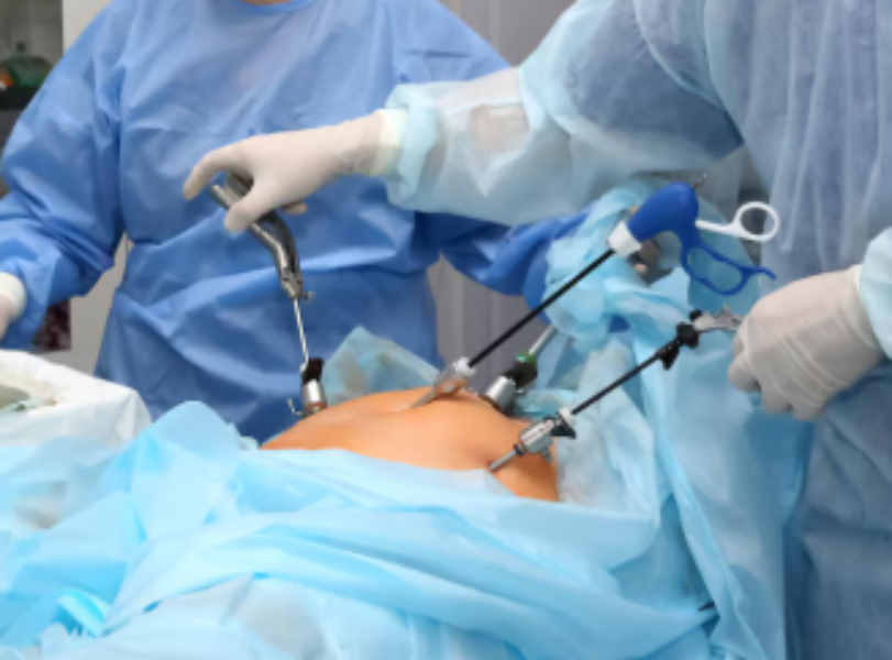 Choosing a Laparoscopic Surgeon in Kengeri and Preparing for Surgical Consultation