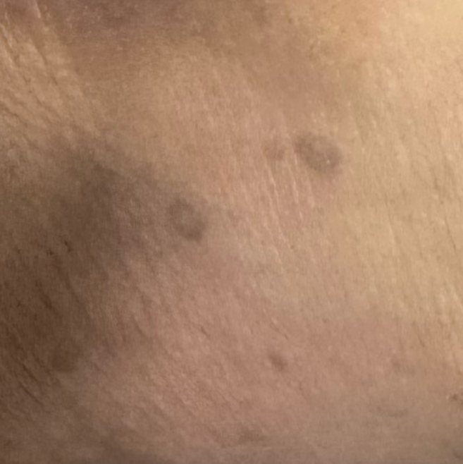 Vibha skin