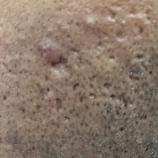 Vibha skin
