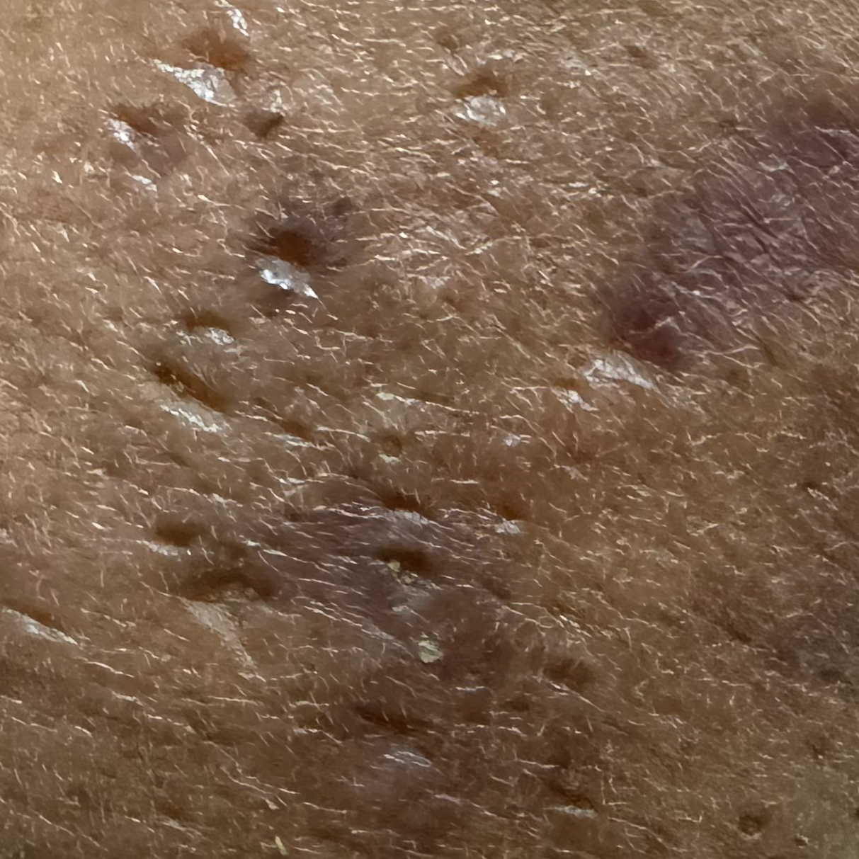 Vibha skin