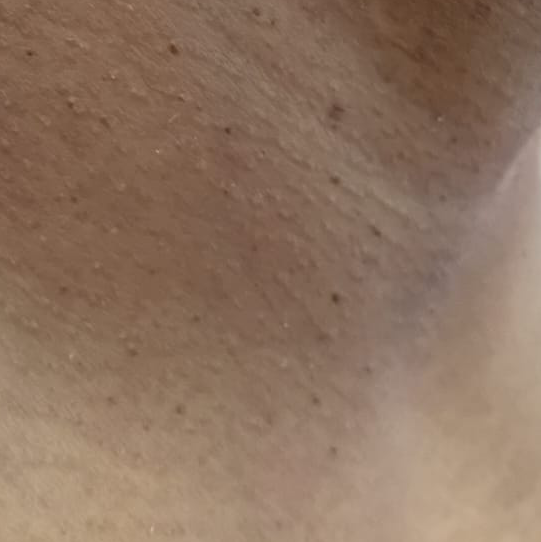 Vibha skin