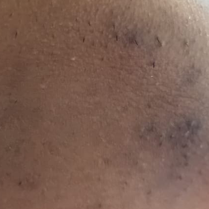 Vibha skin