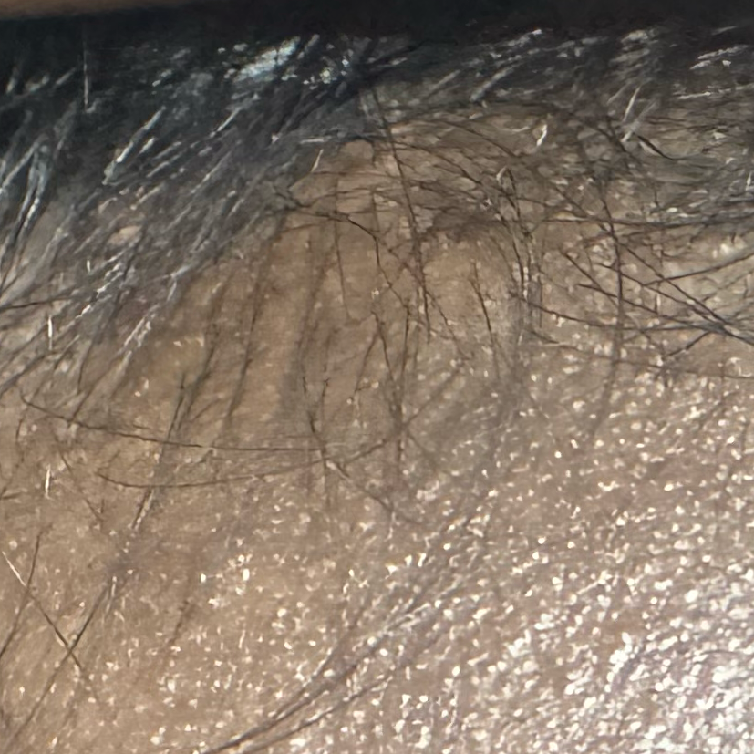 Vibha skin