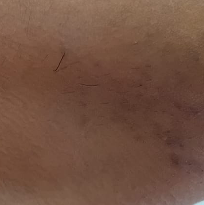 Vibha skin