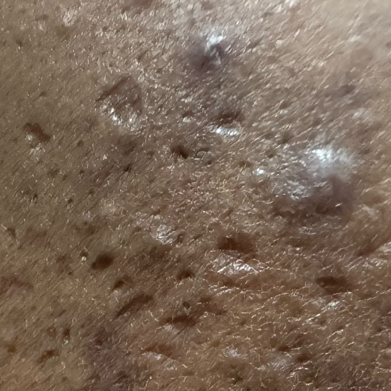 Vibha skin