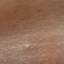 Vibha skin