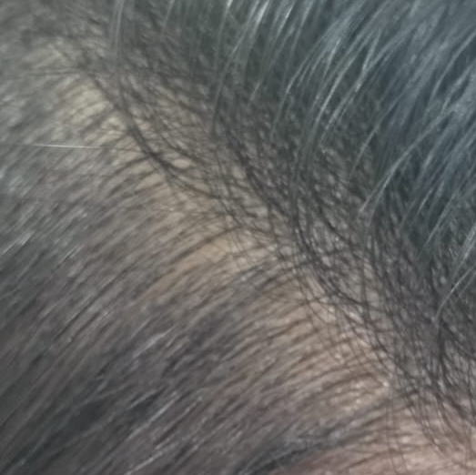 Vibha skin