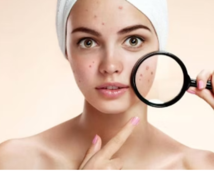 Skin Doctor in Rohini