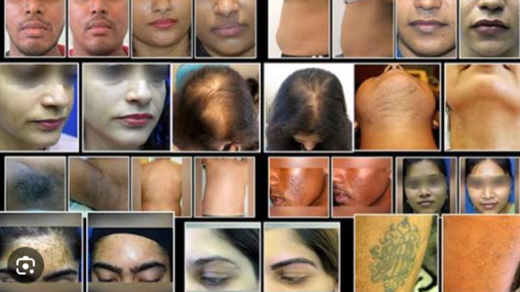 Skin Specialist in Rohini