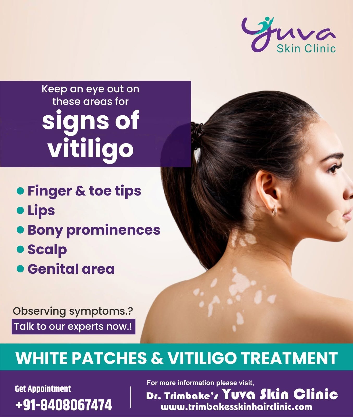 We understand that Vitiligo can be concerning and impact your confidence. Our expert team is here to...