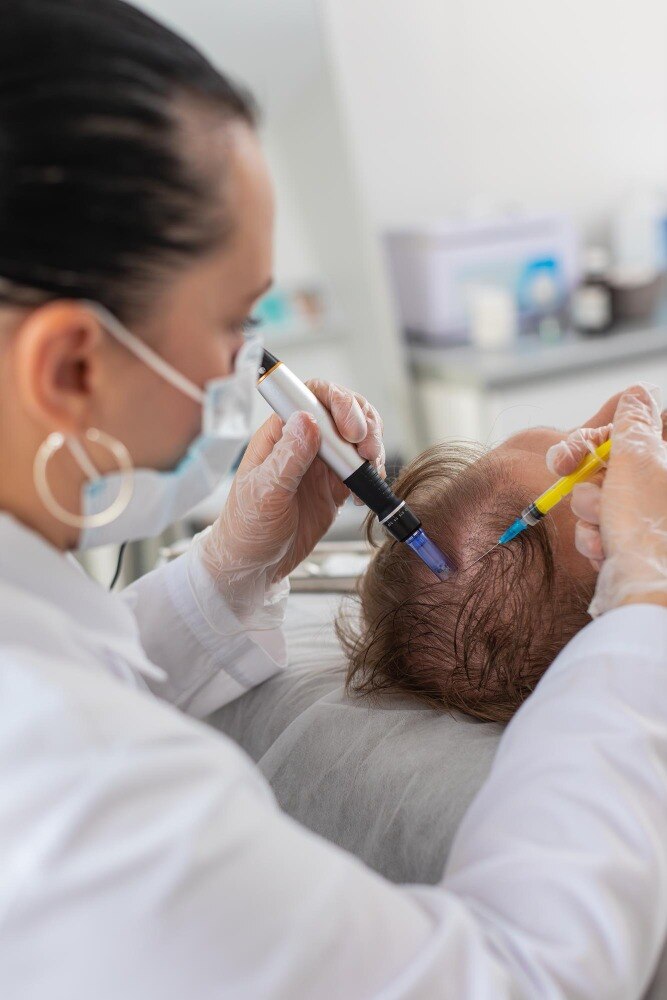 Hair Fall Treatment for Managing Excessive Hair Loss