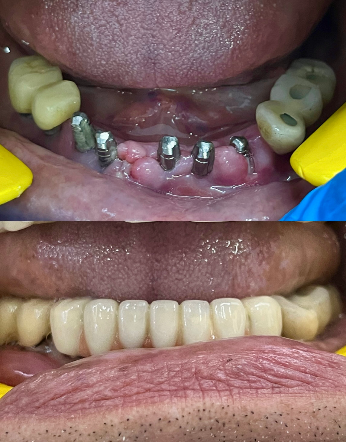 Precision in every implant. Confidence in every smile.
