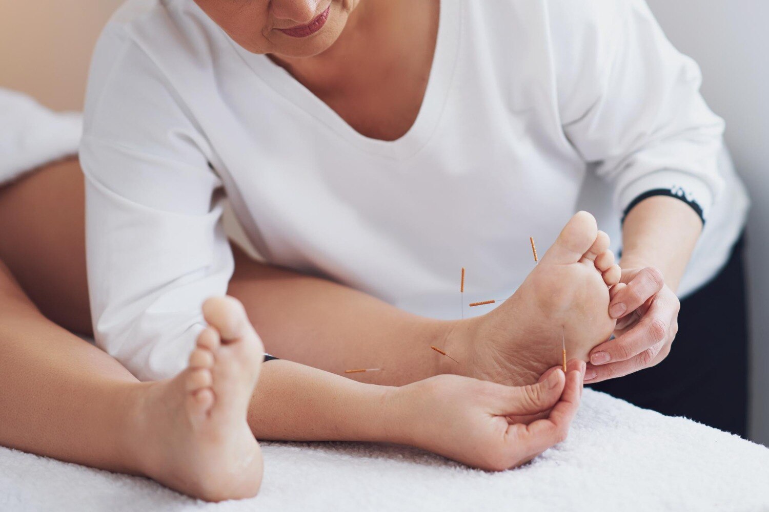 Can Needle Therapy Support Stroke Rehabilitation in Vadodara
