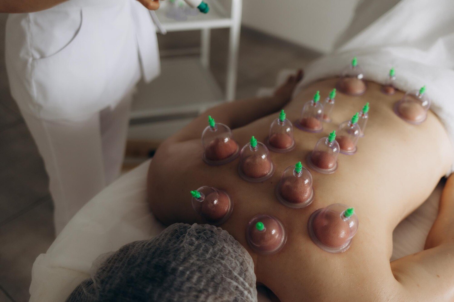 Can Cupping Therapy Support Balance Training for Older Adults in Vadodara