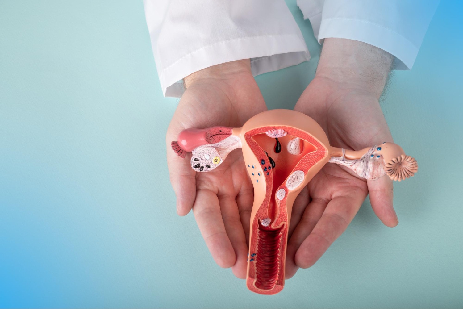 Understanding Endometriosis Through Symptoms Reproductive Needs and Overall Health