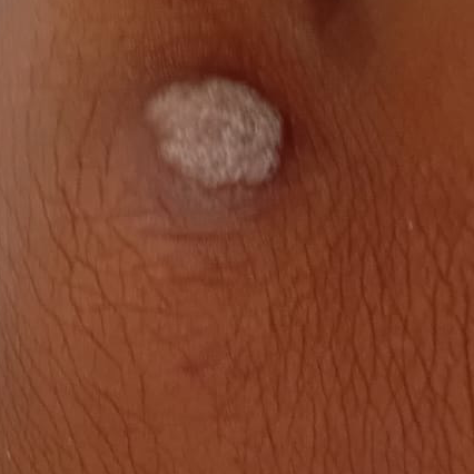 Vibha skin