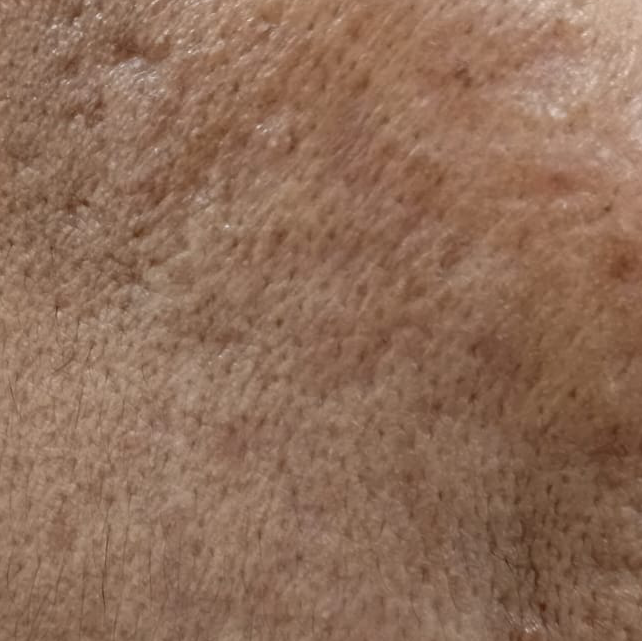 Vibha skin
