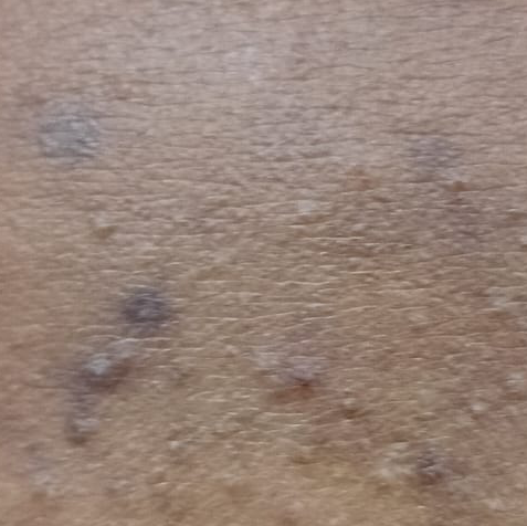 Vibha skin